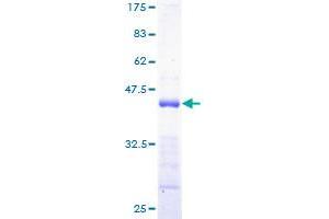 Image no. 1 for Protein Tyrosine Phosphatase Type IVA, Member 3 (PTP4A3) (AA 1-148) protein (GST tag) (ABIN1316805)