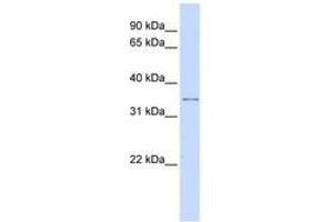 Image no. 1 for anti-Potassium Channel Regulator (KCNRG) (C-Term) antibody (ABIN6742582)