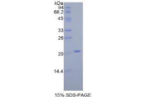 Image no. 1 for Interleukin 17 Receptor E (IL17RE) (AA 457-626) protein (His tag) (ABIN1877511)