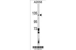 Image no. 1 for anti-C-Type Lectin Domain Family 16, Member A (CLEC16A) (AA 365-391) antibody (ABIN390971)