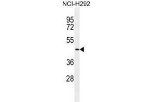 Image no. 1 for anti-Transmembrane Protease, serine 11E (TMPRSS11E) (AA 256-285), (Middle Region) antibody (ABIN955266)