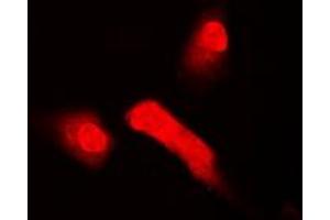 Image no. 1 for anti-T-Box 5 (TBX5) (full length) antibody (ABIN6004744)