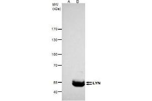 IP Image LYN antibody immunoprecipitates LYN protein in IP experiments.