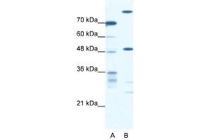Image no. 1 for anti-NFS1 Nitrogen Fixation 1 Homolog (NFS1) antibody (ABIN629670)