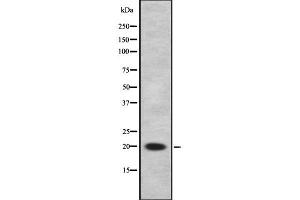 Image no. 1 for anti-Cbp/p300-Interacting Transactivator, with Glu/Asp-Rich Carboxy-terminal Domain, 1 (CITED1) antibody (ABIN6260846)