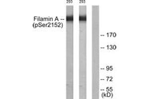 Western blot analysis of extracts from 293 cells treated with EGF 200ng/ml 5', using Filamin A (Phospho-Ser2152) Antibody.