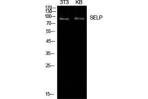 Image no. 3 for anti-Selectin P (Granule Membrane Protein 140kDa, Antigen CD62) (SELP) (Internal Region) antibody (ABIN3188020)