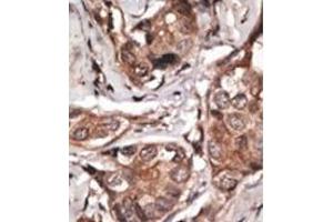 Image no. 2 for anti-HtrA Serine Peptidase 1 (HTRA1) (AA 389-419), (C-Term) antibody (ABIN356844)