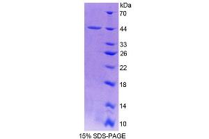 Image no. 1 for Profilin 3 (PFN3) protein (ABIN3011298)