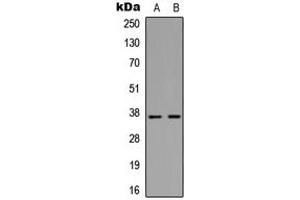 Image no. 3 for anti-Matrix Metallopeptidase 10 (Stromelysin 2) (MMP10) (C-Term) antibody (ABIN2704991)