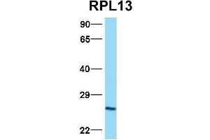 Image no. 4 for anti-Ribosomal Protein L13 (RPL13) (C-Term) antibody (ABIN2778677)