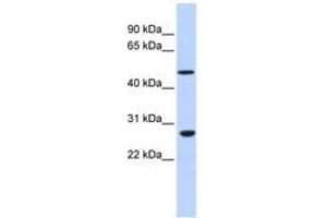 Image no. 1 for anti-Zinc Finger Protein 556 (ZNF556) (AA 36-85) antibody (ABIN6740460)