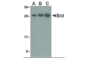 Image no. 1 for anti-BH3 Interacting Domain Death Agonist (BID) (C-Term) antibody (ABIN6655690)