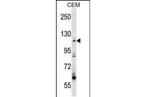 Image no. 1 for anti-rho Guanine Nucleotide Exchange Factor (GEF) 1 (ARHGEF1) (AA 164-192), (N-Term) antibody (ABIN5532794)