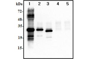 Image no. 4 for anti-Interleukin 37 (IL37) antibody (ABIN1169178)
