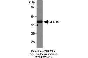 Image no. 1 for anti-Solute Carrier Family 2 (Facilitated Glucose Transporter), Member 9 (SLC2A9) (AA 400-450) antibody (ABIN363669)