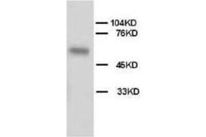 Image no. 4 for anti-Alkaline Phosphatase, Liver/bone/kidney (ALPL) (AA 21-35), (N-Term) antibody (ABIN3044314)