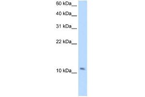 anti-Small Muscle Protein, X-Linked (SMPX) (Middle Region) antibody