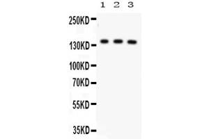 Image no. 1 for anti-ATP-Binding Cassette, Sub-Family B (MDR/TAP), Member 11 (ABCB11) (C-Term) antibody (ABIN6657515)