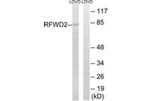 Image no. 1 for anti-Ring Finger and WD Repeat Domain 2, E3 Ubiquitin Protein Ligase (RFWD2) (AA 661-710) antibody (ABIN1534866)