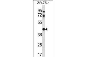 Image no. 2 for anti-Cathepsin O (CTSO) (AA 69-98), (N-Term) antibody (ABIN5535101)