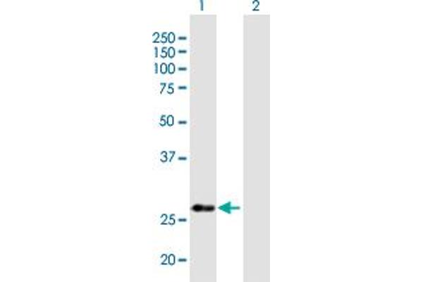 anti-Nucleotide Binding Protein 2 (NUBP2) (AA 1-271) antibody
