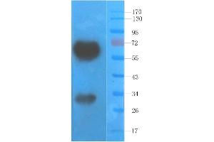 Image no. 1 for anti-Vascular Endothelial Growth Factor (VEGF) antibody (ABIN5668149)