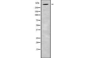 Image no. 1 for anti-Alstrom Syndrome 1 (ALMS1) (C-Term) antibody (ABIN6259890)