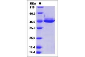 Image no. 1 for Chitinase 3-Like 3 (CHI3L3) (AA 1-398) protein (His tag) (ABIN2008718)