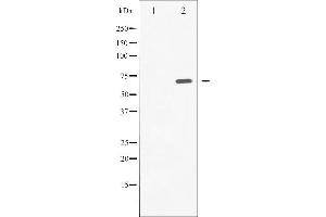 Image no. 11 for anti-Spleen tyrosine Kinase (SYK) (pTyr525) antibody (ABIN6255944)