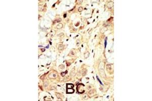 Image no. 2 for anti-V-Erb-A erythroblastic Leukemia Viral Oncogene Homolog 4 (Avian) (ERBB4) (AA 25-55), (N-Term) antibody (ABIN391950)