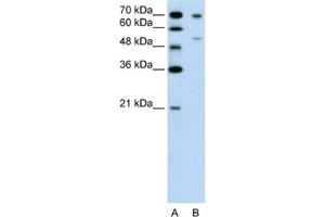 Image no. 1 for anti-Forkhead Box B2 (FOXB2) antibody (ABIN2462637)