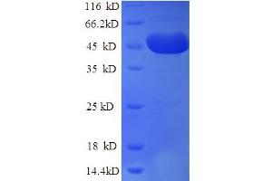 DCP2 Protein (AA 1-385, Isoform 2) (His tag)