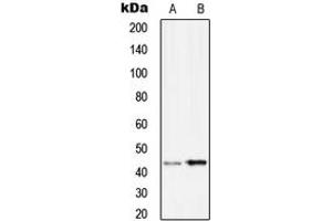 Image no. 2 for anti-serpin Peptidase Inhibitor, Clade B (Ovalbumin), Member 9 (SERPINB9) (Center) antibody (ABIN2707030)