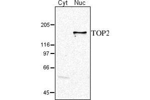 Image no. 1 for anti-DNA Topoisomerase II (TOP2) (C-Term), (N-Term) antibody (ABIN334538)