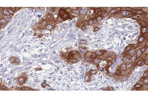 Image no. 3 for anti-CD83 (CD83) antibody (ABIN6260656)