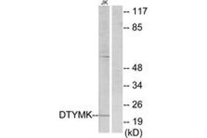 Image no. 1 for anti-Deoxythymidylate Kinase (Thymidylate Kinase) (DTYMK) (AA 1-50) antibody (ABIN1533669)