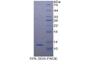 Image no. 1 for Sema Domain, Immunoglobulin Domain (Ig), Short Basic Domain, Secreted, (Semaphorin) 3E (SEMA3E) protein (ABIN3011608)