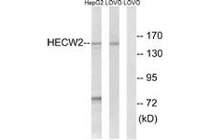 Image no. 1 for anti-HECT, C2 and WW Domain Containing E3 Ubiquitin Protein Ligase 2 (HECW2) (AA 481-530) antibody (ABIN1534859)