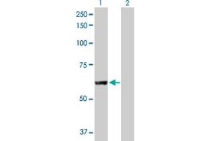 Image no. 1 for anti-Patatin-Like phospholipase Domain Containing 2 (PNPLA2) (AA 1-504) antibody (ABIN528090)