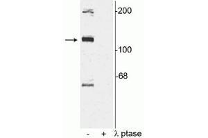Image no. 2 for anti-TAO Kinase 2 (TAOK2) (pSer181) antibody (ABIN361519)