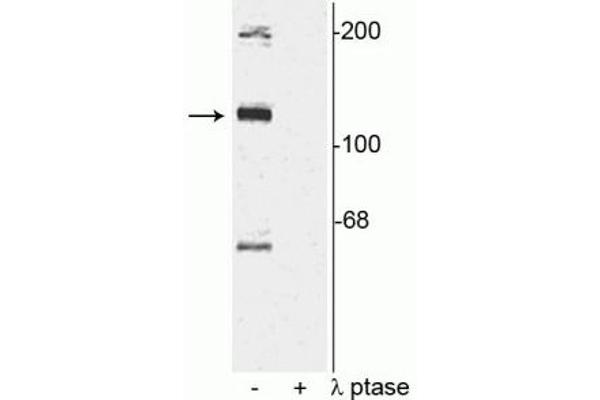 TAO Kinase 2 antibody  (pSer181)