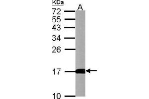 Image no. 2 for anti-Microtubule-Associated Protein 1 Light Chain 3 beta (MAP1LC3B) (full length) antibody (ABIN2854667)