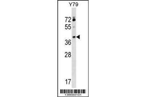 Image no. 1 for anti-Kelch Domain Containing 8B (KLHDC8B) (AA 245-273), (C-Term) antibody (ABIN1536933)