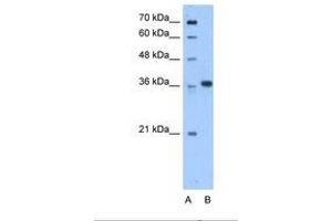 Image no. 1 for anti-Aminoadipate-Semialdehyde Dehydrogenase-phosphopantetheinyl Transferase (AASDHPPT) (C-Term) antibody (ABIN6738500)
