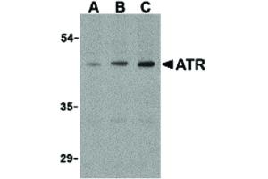 ATR antibody  (Internal Region)