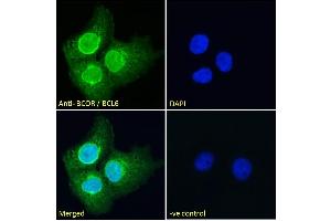 Image no. 1 for anti-BCL6 Co-Repressor (BCOR) (N-Term) antibody (ABIN185043)