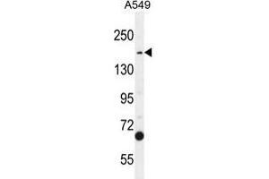 Image no. 1 for anti-Tudor Domain Containing 7 (TDRD7) (AA 807-835), (C-Term) antibody (ABIN955135)