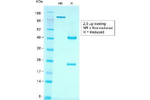 Image no. 4 for anti-Cadherin-16 (CDH16) antibody (ABIN6939021)
