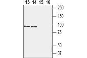 Western blot analysis of rat (lanes 13and 15)  and mouse (lanes 14 and 16) spleen lysate: - 13, 14.
